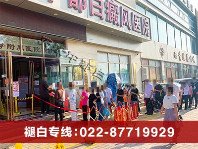 天津中都白癜風醫院